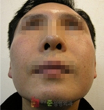 GangNam June Cosmetic Surgery Clinic,Reviews,Images, Promotions — Korea cost, reviews & before-after | MISOODA
