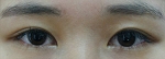 ABC Plastic Surgery,Reviews,Images, Promotions — Korea cost, reviews & before-after | MISOODA