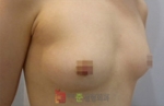 GangNam June Cosmetic Surgery Clinic,Reviews,Images, Promotions — Korea cost, reviews & before-after | MISOODA