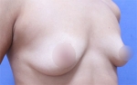 ABC Plastic Surgery,Reviews,Images, Promotions — Korea cost, reviews & before-after | MISOODA