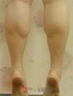 GangNam June Cosmetic Surgery Clinic,Reviews,Images, Promotions — Korea cost, reviews & before-after | MISOODA