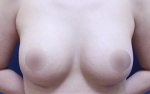 ABC Plastic Surgery,Reviews,Images, Promotions — Korea cost, reviews & before-after | MISOODA