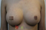 GangNam June Cosmetic Surgery Clinic,Reviews,Images, Promotions — Korea cost, reviews & before-after | MISOODA
