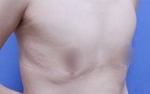 ABC Plastic Surgery,Reviews,Images, Promotions — Korea cost, reviews & before-after | MISOODA