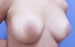ABC Plastic Surgery,Reviews,Images, Promotions — Korea cost, reviews & before-after | MISOODA