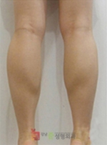 GangNam June Cosmetic Surgery Clinic,Reviews,Images, Promotions — Korea cost, reviews & before-after | MISOODA