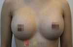 GangNam June Cosmetic Surgery Clinic,Reviews,Images, Promotions — Korea cost, reviews & before-after | MISOODA