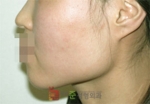 GangNam June Cosmetic Surgery Clinic,Reviews,Images, Promotions — Korea cost, reviews & before-after | MISOODA