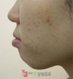 GangNam June Cosmetic Surgery Clinic,Reviews,Images, Promotions — Korea cost, reviews & before-after | MISOODA