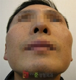 GangNam June Cosmetic Surgery Clinic,Reviews,Images, Promotions — Korea cost, reviews & before-after | MISOODA