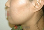 GangNam June Cosmetic Surgery Clinic,Reviews,Images, Promotions — Korea cost, reviews & before-after | MISOODA