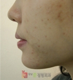 GangNam June Cosmetic Surgery Clinic,Reviews,Images, Promotions — Korea cost, reviews & before-after | MISOODA