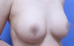 ABC Plastic Surgery,Reviews,Images, Promotions — Korea cost, reviews & before-after | MISOODA