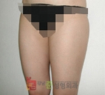 GangNam June Cosmetic Surgery Clinic,Reviews,Images, Promotions — Korea cost, reviews & before-after | MISOODA