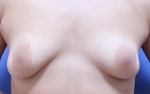 ABC Plastic Surgery,Reviews,Images, Promotions — Korea cost, reviews & before-after | MISOODA