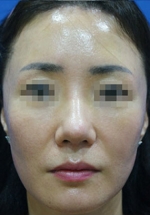 ABC Plastic Surgery,Reviews,Images, Promotions — Korea cost, reviews & before-after | MISOODA