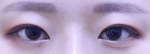 ABC Plastic Surgery,Reviews,Images, Promotions — Korea cost, reviews & before-after | MISOODA