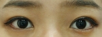 ABC Plastic Surgery,Reviews,Images, Promotions — Korea cost, reviews & before-after | MISOODA