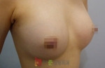 GangNam June Cosmetic Surgery Clinic,Reviews,Images, Promotions — Korea cost, reviews & before-after | MISOODA