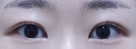 ABC Plastic Surgery,Reviews,Images, Promotions — Korea cost, reviews & before-after | MISOODA