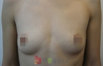 GangNam June Cosmetic Surgery Clinic,Reviews,Images, Promotions — Korea cost, reviews & before-after | MISOODA