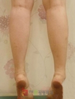 GangNam June Cosmetic Surgery Clinic,Reviews,Images, Promotions — Korea cost, reviews & before-after | MISOODA