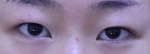 ABC Plastic Surgery,Reviews,Images, Promotions — Korea cost, reviews & before-after | MISOODA