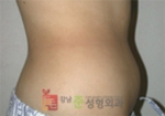 GangNam June Cosmetic Surgery Clinic,Reviews,Images, Promotions — Korea cost, reviews & before-after | MISOODA