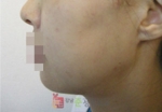 GangNam June Cosmetic Surgery Clinic,Reviews,Images, Promotions — Korea cost, reviews & before-after | MISOODA