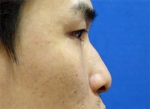ABC Plastic Surgery,Reviews,Images, Promotions — Korea cost, reviews & before-after | MISOODA