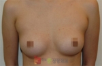 GangNam June Cosmetic Surgery Clinic,Reviews,Images, Promotions — Korea cost, reviews & before-after | MISOODA