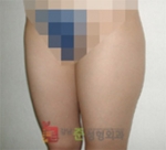 GangNam June Cosmetic Surgery Clinic,Reviews,Images, Promotions — Korea cost, reviews & before-after | MISOODA