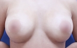 ABC Plastic Surgery,Reviews,Images, Promotions — Korea cost, reviews & before-after | MISOODA
