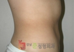 GangNam June Cosmetic Surgery Clinic,Reviews,Images, Promotions — Korea cost, reviews & before-after | MISOODA