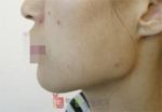 GangNam June Cosmetic Surgery Clinic,Reviews,Images, Promotions — Korea cost, reviews & before-after | MISOODA