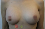 GangNam June Cosmetic Surgery Clinic,Reviews,Images, Promotions — Korea cost, reviews & before-after | MISOODA