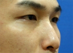 ABC Plastic Surgery,Reviews,Images, Promotions — Korea cost, reviews & before-after | MISOODA