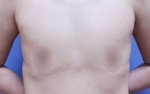 ABC Plastic Surgery,Reviews,Images, Promotions — Korea cost, reviews & before-after | MISOODA