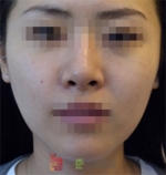 GangNam June Cosmetic Surgery Clinic,Reviews,Images, Promotions — Korea cost, reviews & before-after | MISOODA