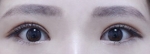 ABC Plastic Surgery,Reviews,Images, Promotions — Korea cost, reviews & before-after | MISOODA