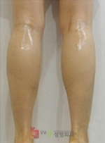 GangNam June Cosmetic Surgery Clinic,Reviews,Images, Promotions — Korea cost, reviews & before-after | MISOODA