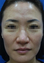 ABC Plastic Surgery,Reviews,Images, Promotions — Korea cost, reviews & before-after | MISOODA