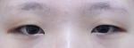 ABC Plastic Surgery,Reviews,Images, Promotions — Korea cost, reviews & before-after | MISOODA