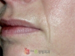 GangNam June Cosmetic Surgery Clinic,Reviews,Images, Promotions — Korea cost, reviews & before-after | MISOODA