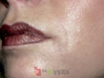 GangNam June Cosmetic Surgery Clinic,Reviews,Images, Promotions — Korea cost, reviews & before-after | MISOODA