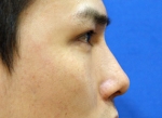 ABC Plastic Surgery,Reviews,Images, Promotions — Korea cost, reviews & before-after | MISOODA
