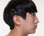 ABC Plastic Surgery,Reviews,Images, Promotions — Korea cost, reviews & before-after | MISOODA