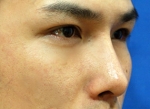 ABC Plastic Surgery,Reviews,Images, Promotions — Korea cost, reviews & before-after | MISOODA
