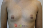 GangNam June Cosmetic Surgery Clinic,Reviews,Images, Promotions — Korea cost, reviews & before-after | MISOODA