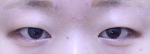 ABC Plastic Surgery,Reviews,Images, Promotions — Korea cost, reviews & before-after | MISOODA
